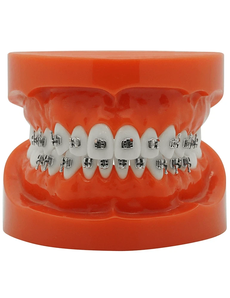 Laser Mini Bracket (MBT)