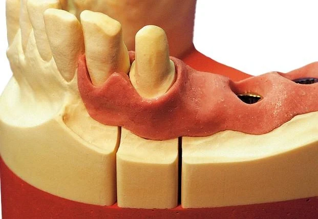 MAJESTHETIC-GINGIIMPLANT 2 x 50 ml